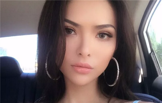 鼻小柱延长术的效果，鼻小柱过短，鼻小柱延长术的价格，鼻小柱延长术术后注意事项，