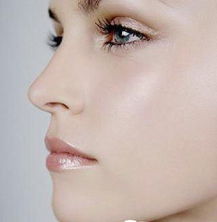 自体软骨隆鼻好不好