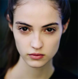 膨体隆鼻手术时间是多久