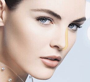 成都鼻翼整形需要多少钱