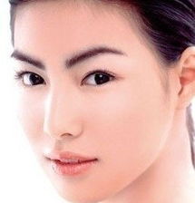 歪鼻有哪些矫正的方法,歪鼻矫正术,歪鼻整形,效果