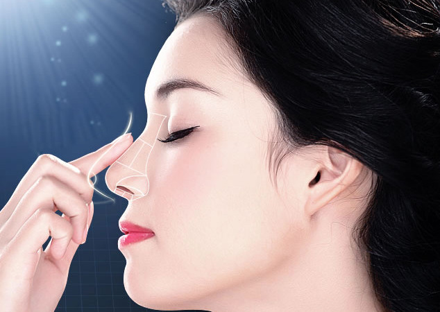 自体软骨隆鼻优势，隆鼻材料，耳软骨隆鼻恢复时间，自体软骨隆鼻手术后注意，