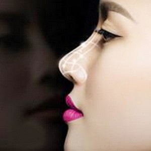 鼻子线雕多久消肿，线雕隆鼻几天可以消肿呢,哪些因素影响线雕隆鼻消肿时间 