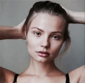 鼻综合手术的恢复期