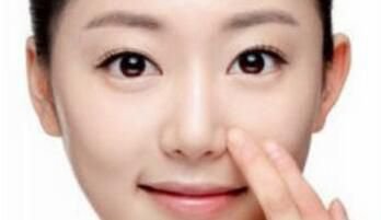 自体软骨隆鼻的效果