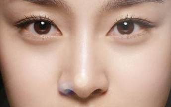 硅胶隆鼻的效果