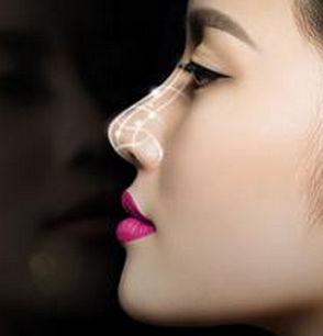 鼻尖整形手术方法，鼻翼软骨，鼻部整形，鼻翼软骨，侧鼻软骨，鼻中隔软骨，隆鼻，