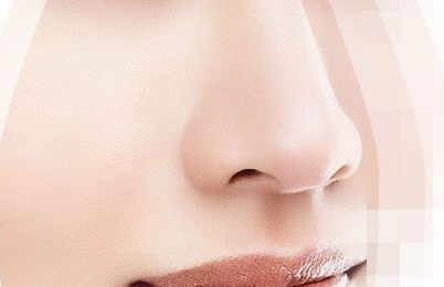 南京垫鼻梁的价格