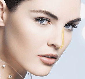 玻尿酸隆鼻与假体的区别