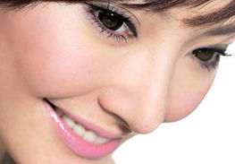 自体耳软骨隆鼻效果