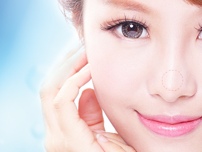 自体软骨隆鼻术的优点