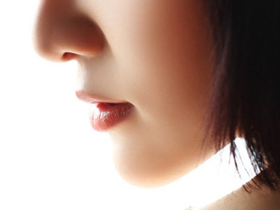  鼻头缩小术后恢复期