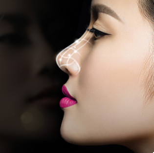 假体隆鼻的术后恢复及相应护理