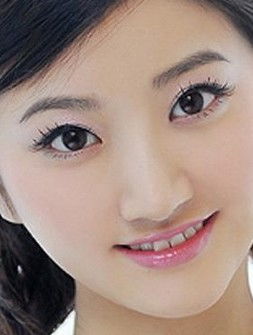 韩式隆鼻术的优势