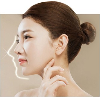 珠海硅胶隆鼻多少钱