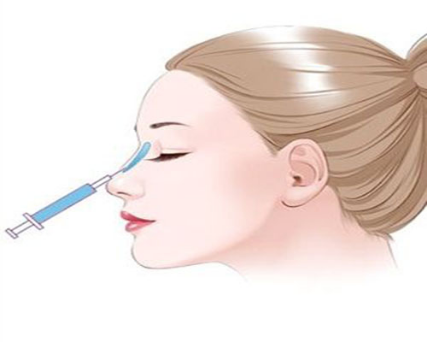 玻尿酸注射隆鼻