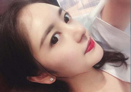 隆鼻手术的基本原则