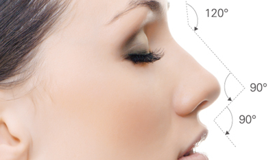 自体软骨隆鼻术