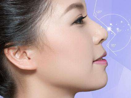 线雕和假体隆鼻哪个好