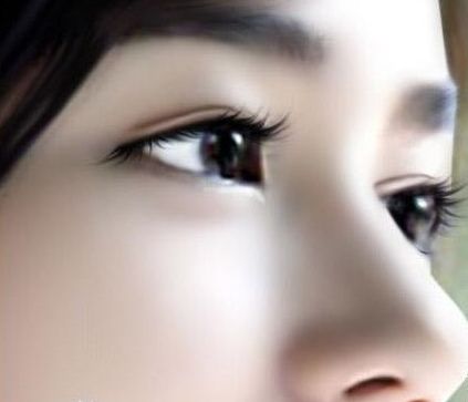 注射隆鼻适合人群