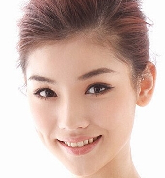 鼻综合整形术后多久能消肿