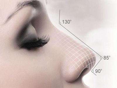 鼻部整形术适合哪些人