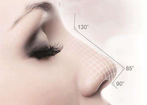 自体真皮隆鼻手术适合哪些人