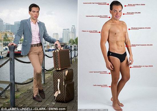 “肯娃娃”第6次隆鼻失败