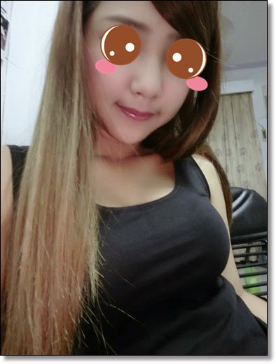 玻尿酸作用太多 这次我做的垫鼻梁+下巴！