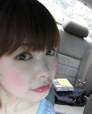 玻尿酸效果好吗？让这位妹子告诉你！