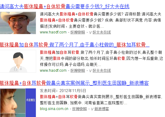 膨体+自体软骨隆鼻