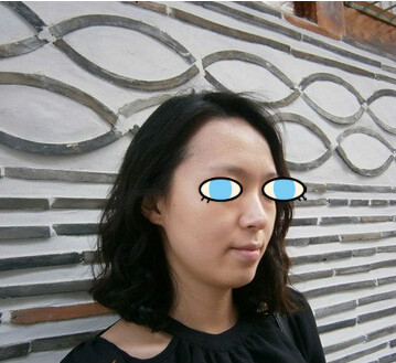 隆鼻手术前的我