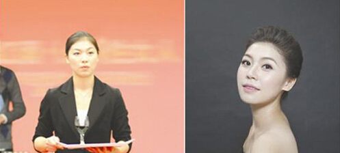 鼻子和下巴微整形让她更时尚 你也可以！