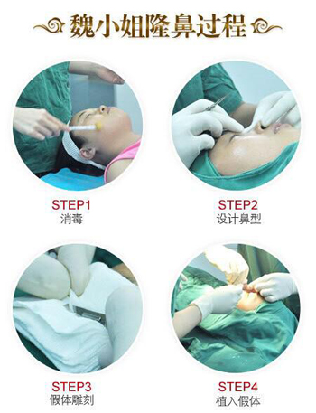 你知道吗？鼻子也能影响到女人的幸福