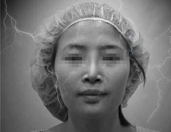 Veeco主要问题为歪鼻