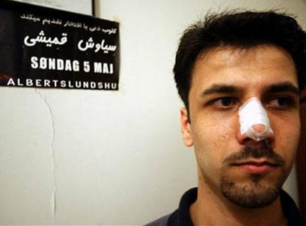 男人都有“高挺鼻情结”？ 韩国/伊朗男人尤爱隆鼻