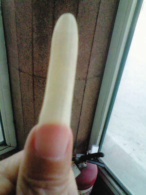 女子想卖指甲给医院隆鼻时用