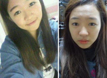 有图有真相 女子隆鼻后收获精美鼻型