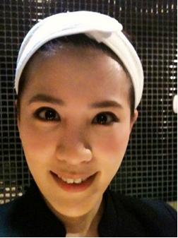 小祯做韩式隆鼻前