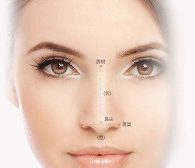 假体隆鼻的优势，注射隆鼻，隆鼻整形，假体隆鼻材料，4、假体隆鼻后效果，隆鼻手术效果，