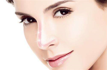 隆鼻失败修复可以改善哪些鼻型