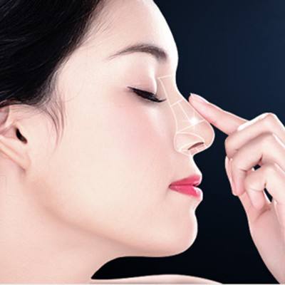 自体软骨隆鼻的优点和缺点是什么？